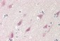 RPS6KB2 / S6K2 Antibody (clone 4B11)